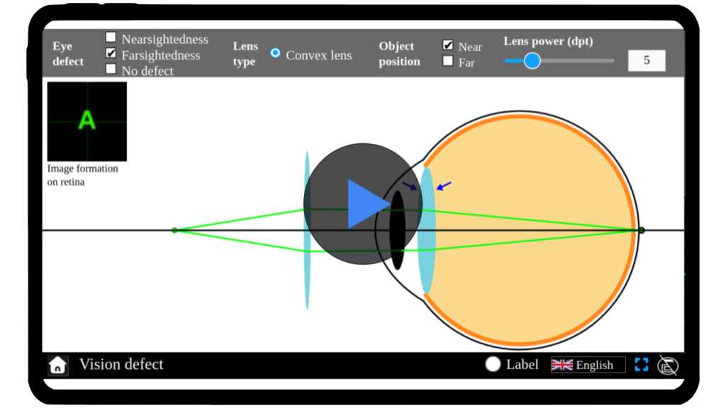 Simulator interface illustrating vision defects, with adjustable options for conditions like myopia and hyperopia. Visuals show how light focuses incorrectly on the retina, demonstrating different corrective lenses. Part of Explerify’s interactive learning tools.