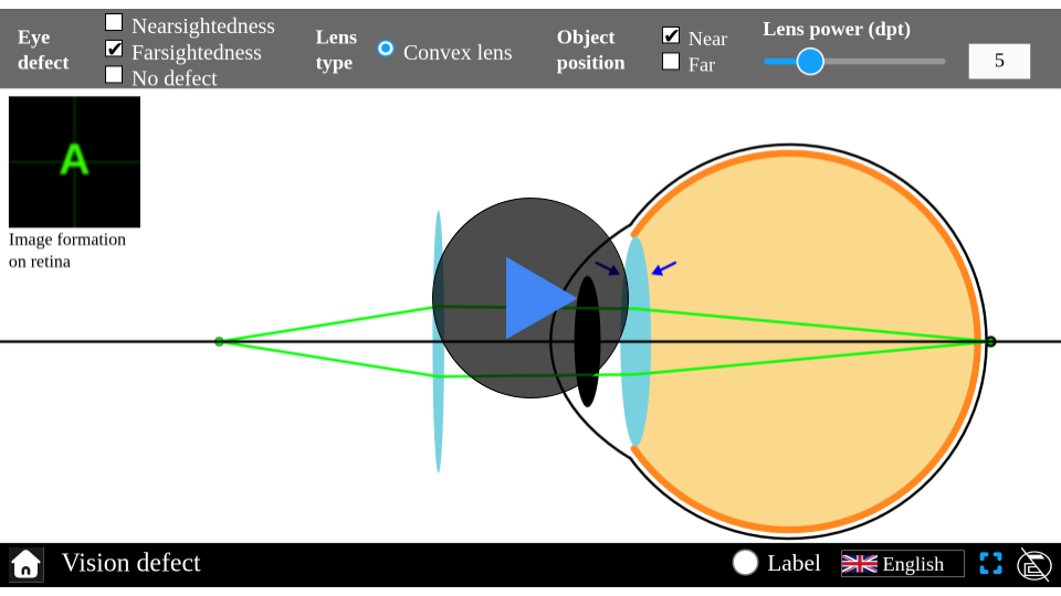 Simulator interface illustrating vision defects, with adjustable options for conditions like myopia and hyperopia. Visuals show how light focuses incorrectly on the retina, demonstrating different corrective lenses. Part of Explerify’s interactive learning tools.