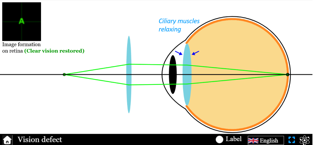 ciliary-muscles- relaxing- due-to- convex-lens